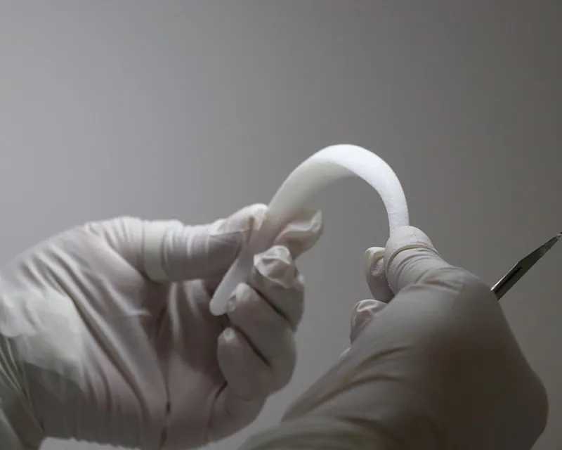 Two hands holding a Poriferous surgical implant
